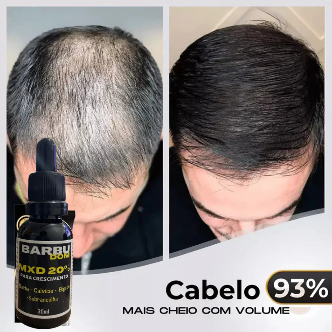 Sérum Capilar MXD20 - PAGUE NA ENTREGA, (Receba em 24 horas)