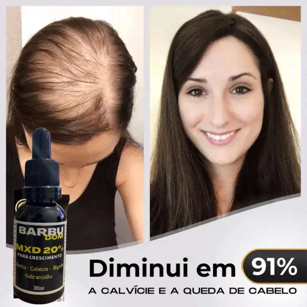 Sérum Capilar MXD20 - PAGUE NA ENTREGA, (Receba em 24 horas)