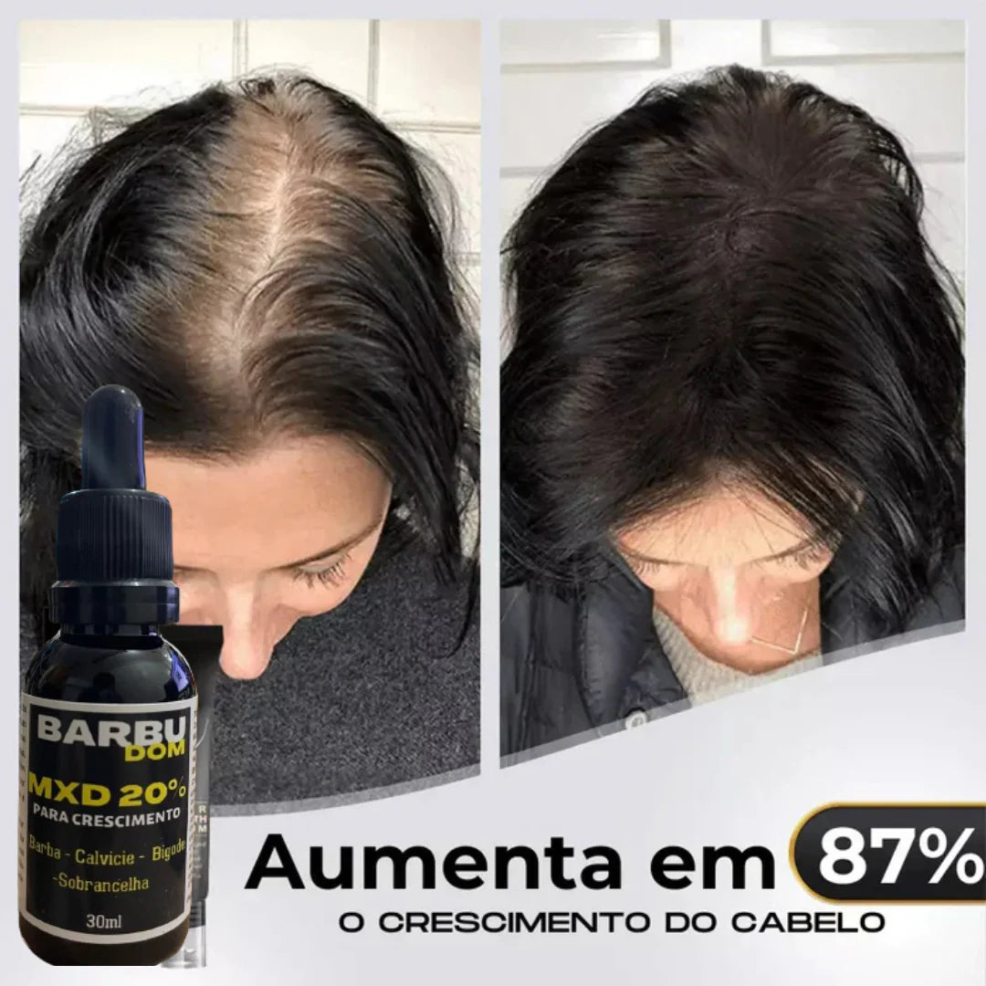 Sérum Capilar MXD20 - PAGUE NA ENTREGA, (Receba em 24 horas)