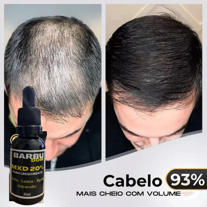 Sérum Capilar MXD20 - PAGUE NA ENTREGA, (Receba em 24 horas)