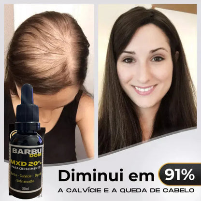 Sérum Capilar MXD20 - PAGUE NA ENTREGA, (Receba em 24 horas)